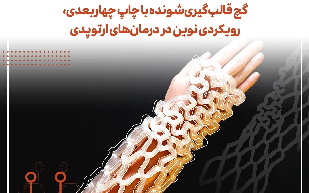 گچ قالب‌گیری‌شونده با چاپ چهار‌بعدی، رویکردی نوین در درمان‌های ارتوپدی